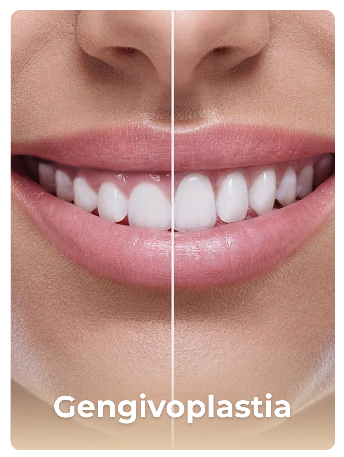 Procedimento de Skinbooster